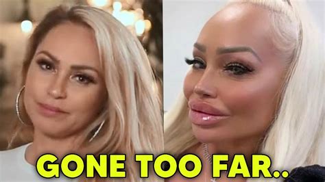 darcy and stacy before and after|darcy and stacey after plastic surgery.